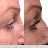 Nu-Cil | Lash & Brow Serum Set