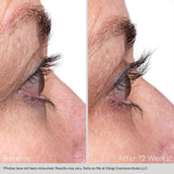 Nu-Cil | Lash & Brow Serum Set