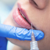 Lip Filler