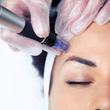 SkinPen Microneedling, with Plasma