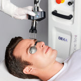 DEKA CoolPeel - Tetra SmartXide CO2 Facial